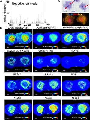 Mass spectrometry imaging as an emerging tool for studying metabolism in human brain organoids